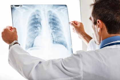 X-ray examination